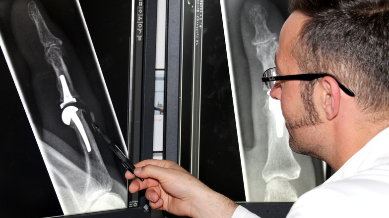 Handchirurg Christian Otis Lorenz vor einem Röntgenbild: Welche Behandlung hilft bei Arthrose in den Fingern?