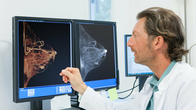 Der Radiologe Karsten Ridder schaut sich die Bilder eines Mamma-CT zur Früherkennung von Brustkrebs an.