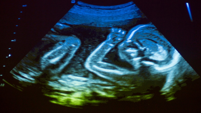 Um den Anfang des Lebens im Mutterleib geht es bei der ersten Veranstaltung von "Reden wir drüber..." Doch wann beginnt Leben überhaupt?