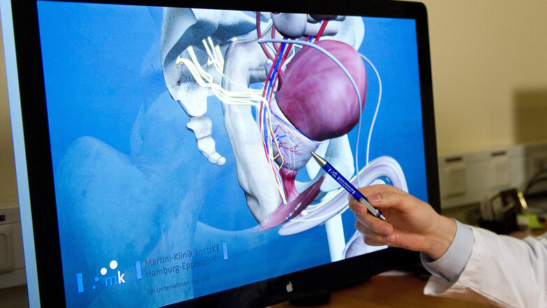 Ein Mediziner zeigt auf einem Bildschirm das 3-D-Modell einer Prostata. Dort kann Krebs entstehen.