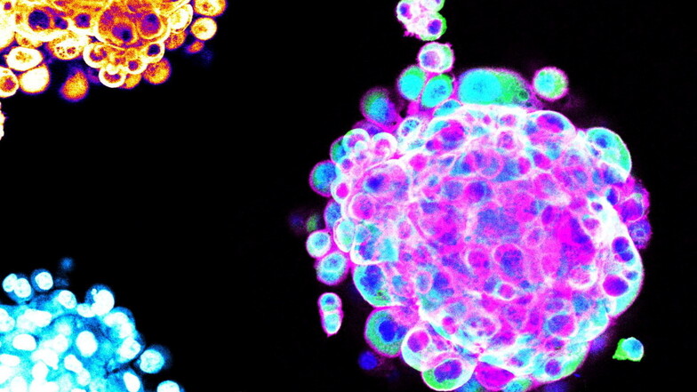 In Hydrogelen bilden sich aus Krebszellen dreidimensionale Zellhaufen, sogenannte Spheroide, hier farbig dargestellt.