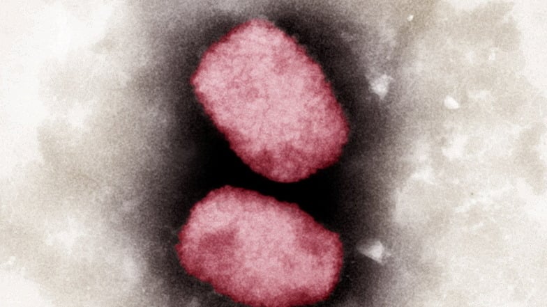 Elektronenmikroskopische Aufnahme von Affenpocken-Viren, koloriert.