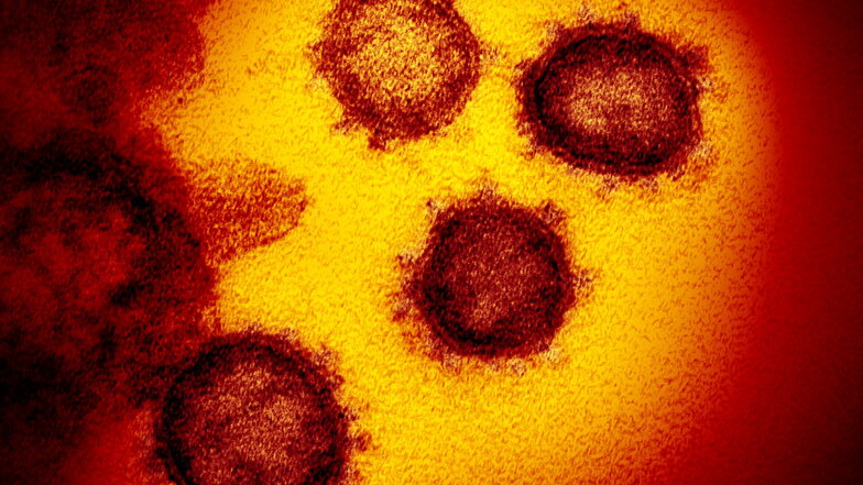 Das Coronavirus SARS-CoV-2, das von einem Patienten in den USA isoliert wurde und aus der Oberfläche von im Labor kultivierten Zellen austritt.