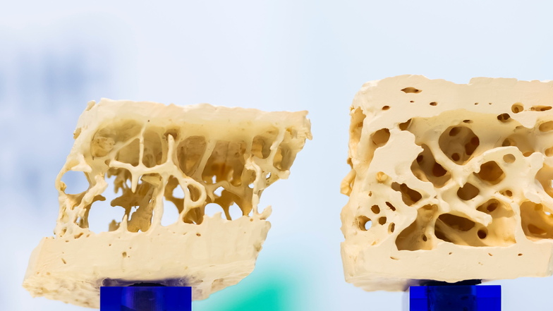 Das Innere unserer Knochen ist hohl, durchdrungen von einem lebendigen schwammartigen Knochengewebe.