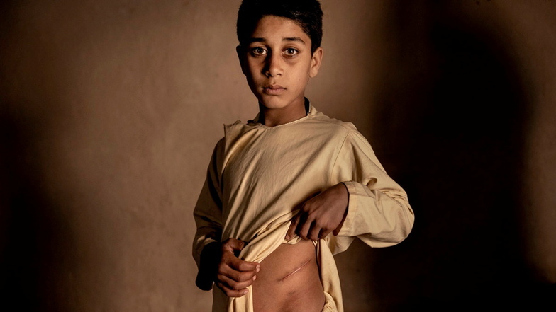 Khalil Ahmads Niere wurde verkauft, um seine Familie zu unterstützen. Die Eltern des 15-jährigen Khalil Ahmad konnten es sich nicht mehr leisten, Essen für ihre elf Kinder zu kaufen.